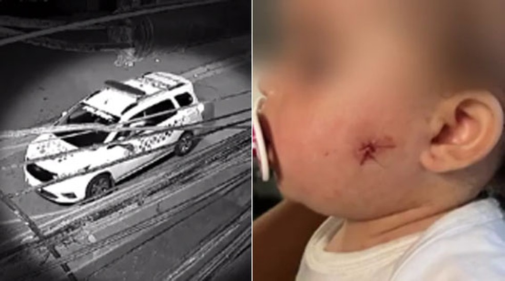 Vídeo: PM atira em rosto de menina de 1 ano com arma de airsoft na Zona  Leste de SP | São Paulo | G1