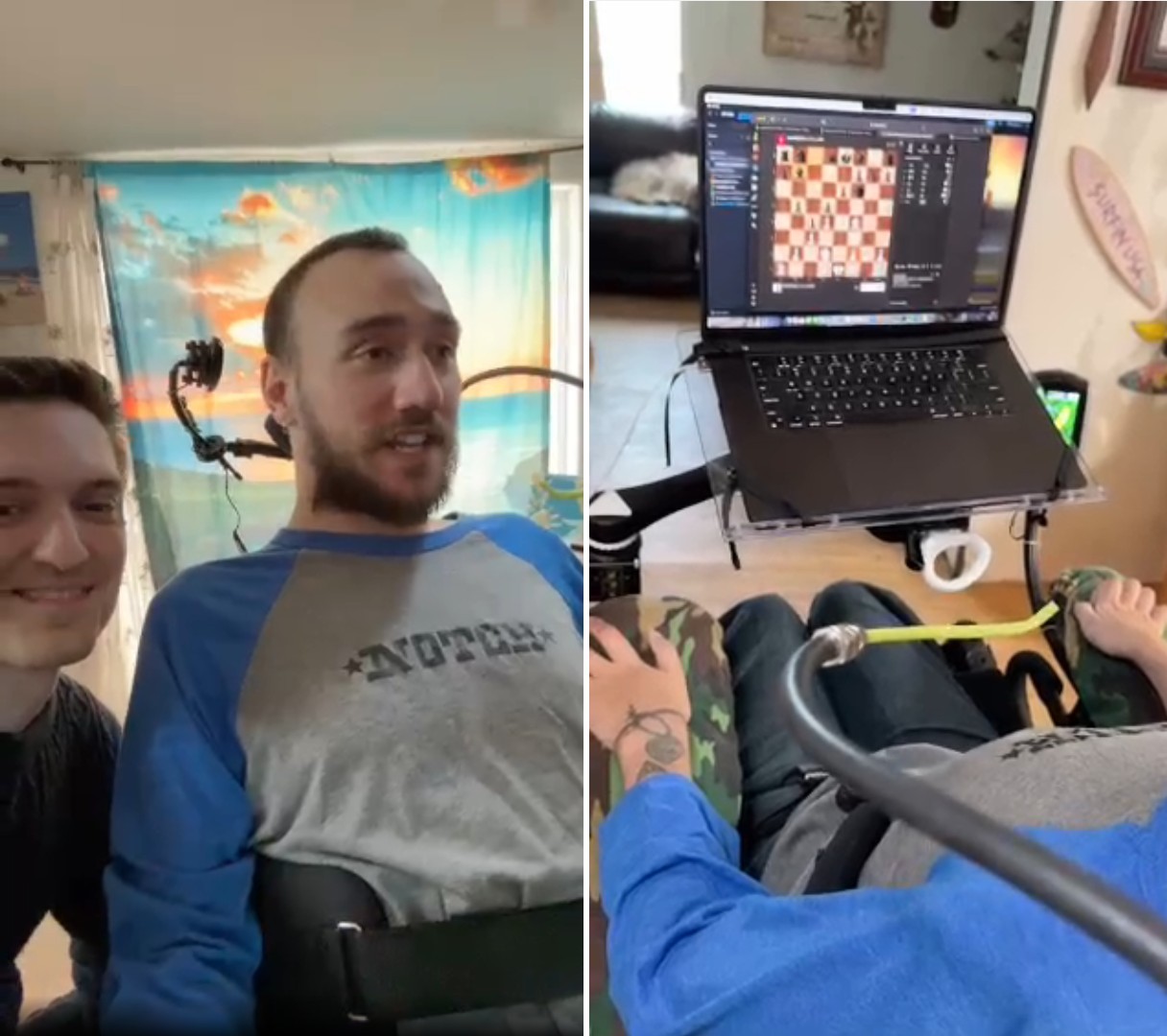 VÍDEO: paciente que recebeu 1º implante da Neuralink mostra como chip cerebral funciona