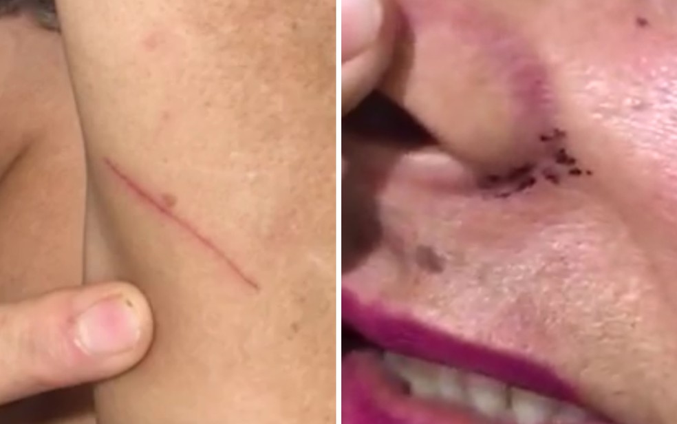 No vídeo a mulher mostra escoriações que teriam sido causadas durante a ação — Foto: Redes Sociais