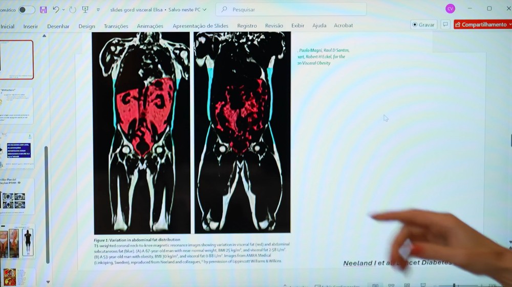 Gordura visceral aumenta risco cardiovascular mesmo em pacientes com pressão e colesterol controlados