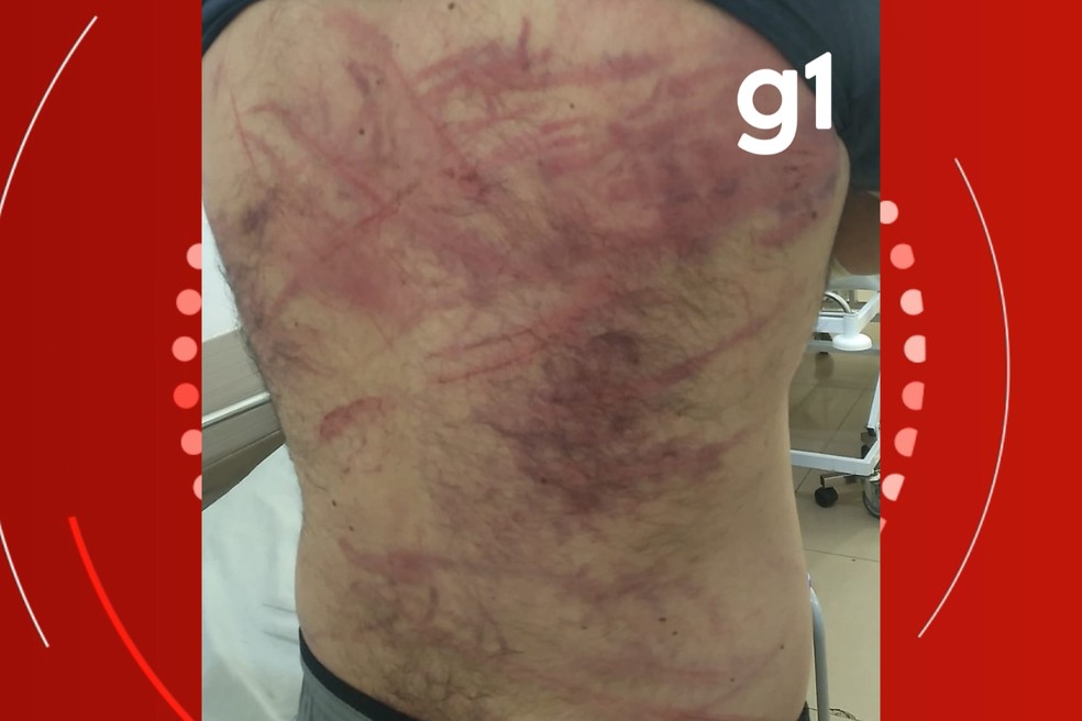 A vítima apresentava sinais de queimaduras, espancamento e marcas de agressão com fio de energia — Foto: Polícia Militar