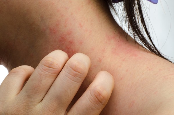 Conheça 10 sinais de que você tem taxas altas de açúcar no sangue | G1