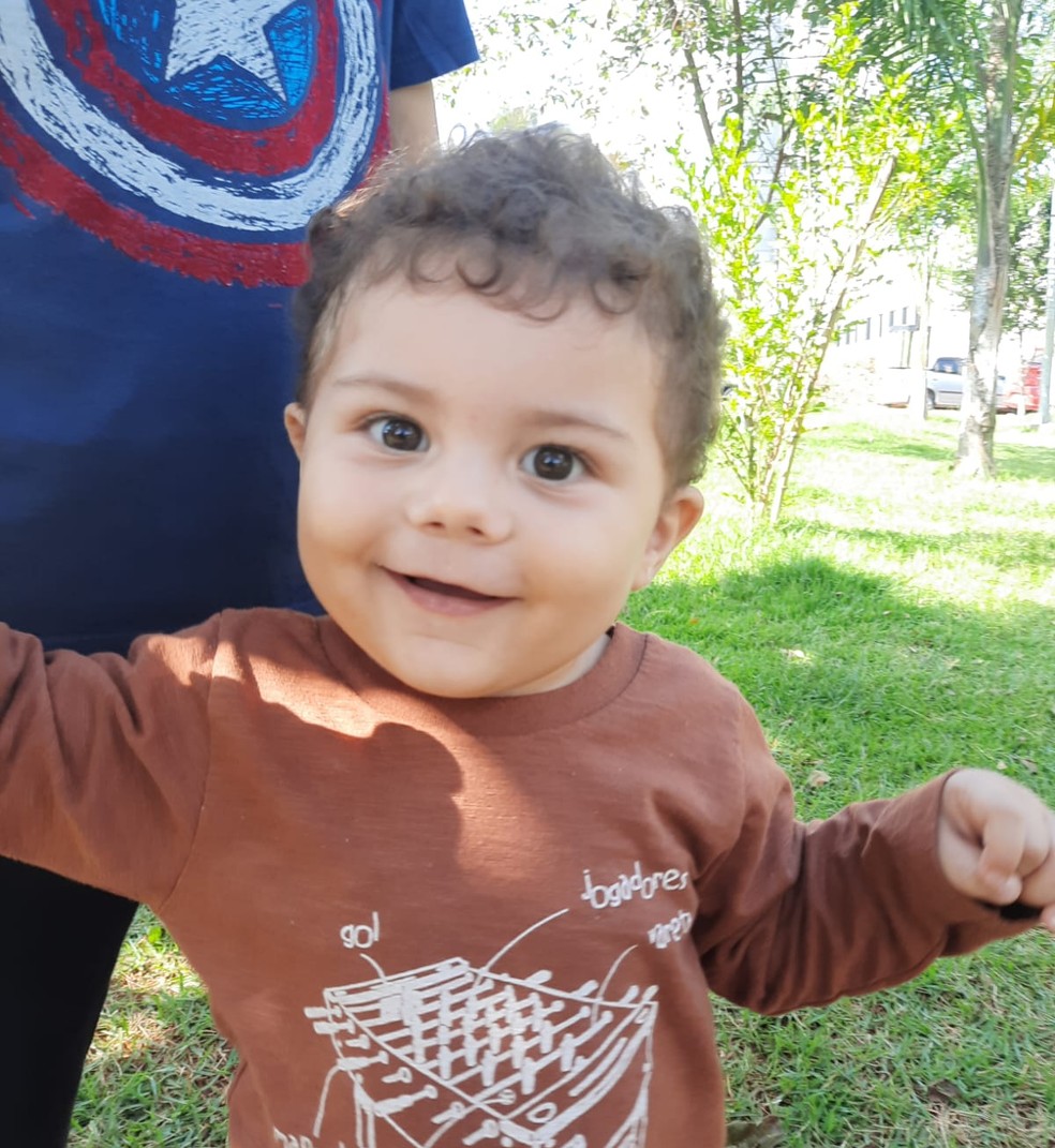 Antônio, bebê de 1 ano e 2 meses de Bauru (SP), convive com alteração genética incomum — Foto: Arquivo pessoal