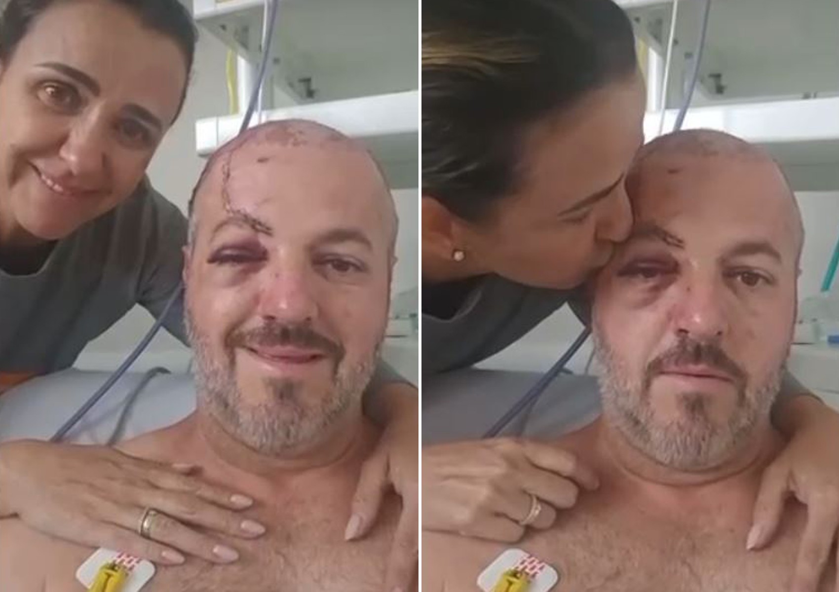 Vítima agradece orações após sobreviver à queda de cobertura de arquibancada em torneio de beach tennis; vídeo