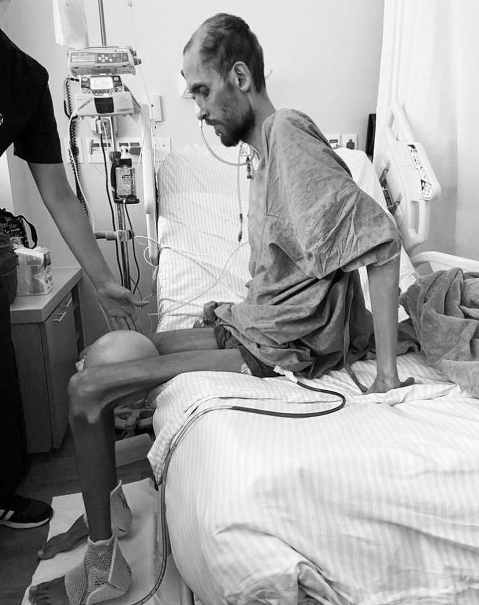 Luiz Perillo, que aguarda o transplante de cinco órgãos, chegou a 34 kg — Foto: Arquivo Pessoal