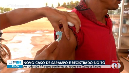 Tocantins registra novo caso de sarampo e soma 17 confirmações da doença