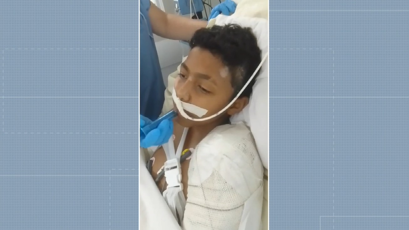 Adolescente atropelado por motorista embriagado e sem CNH em Campinas deixa UTI e se recupera bem, diz avó