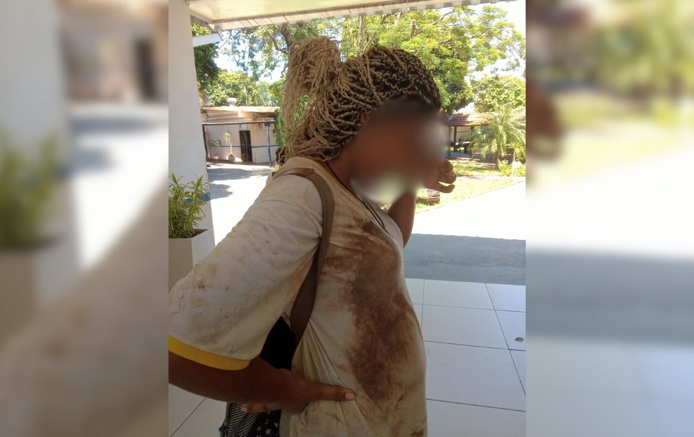 Menina foi agredida na escola por alunos em Novo Horizonte (SP) — Foto: Arquivo pessoal