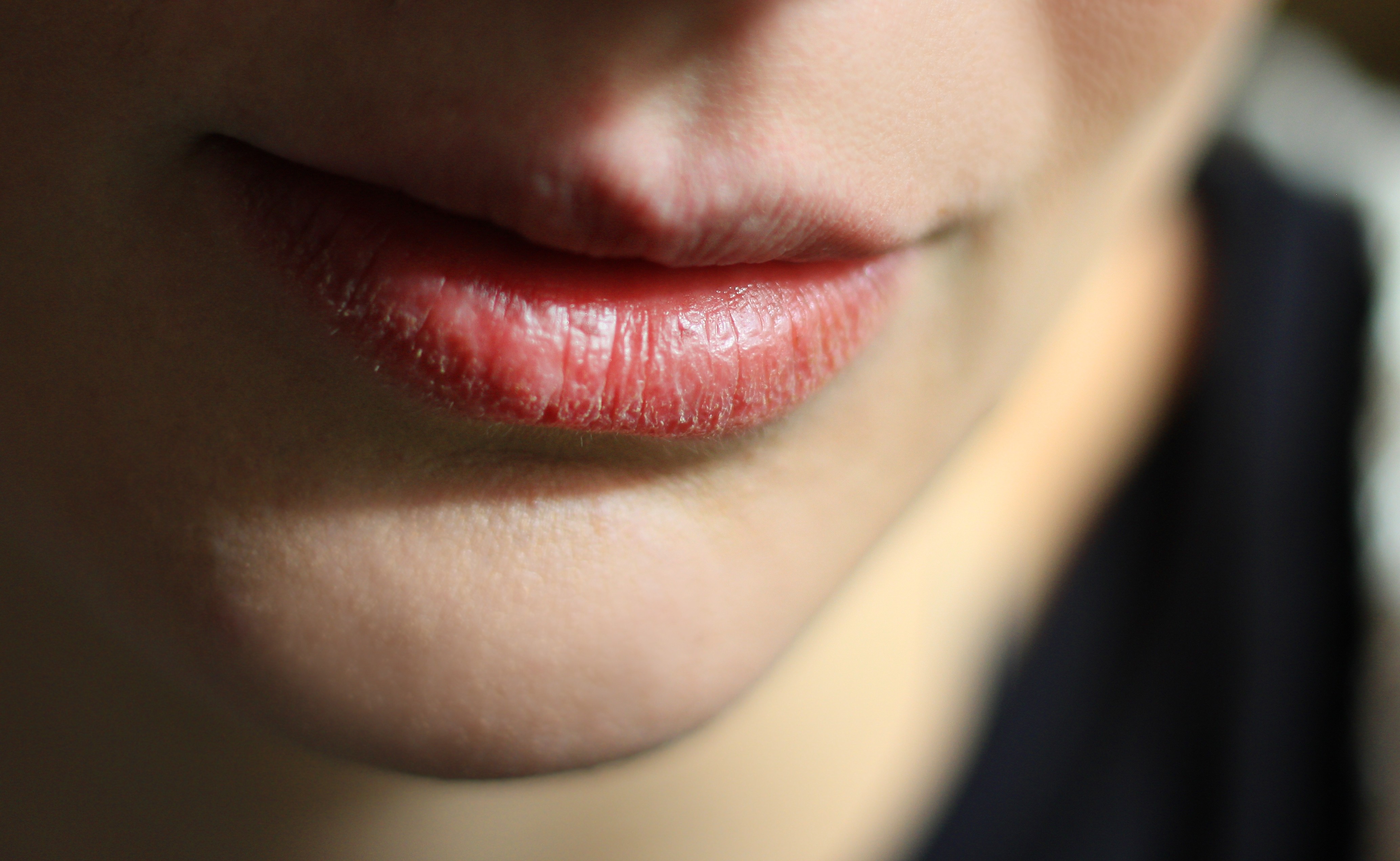 Entenda o sintoma da boca seca e veja como aliviar a sensação