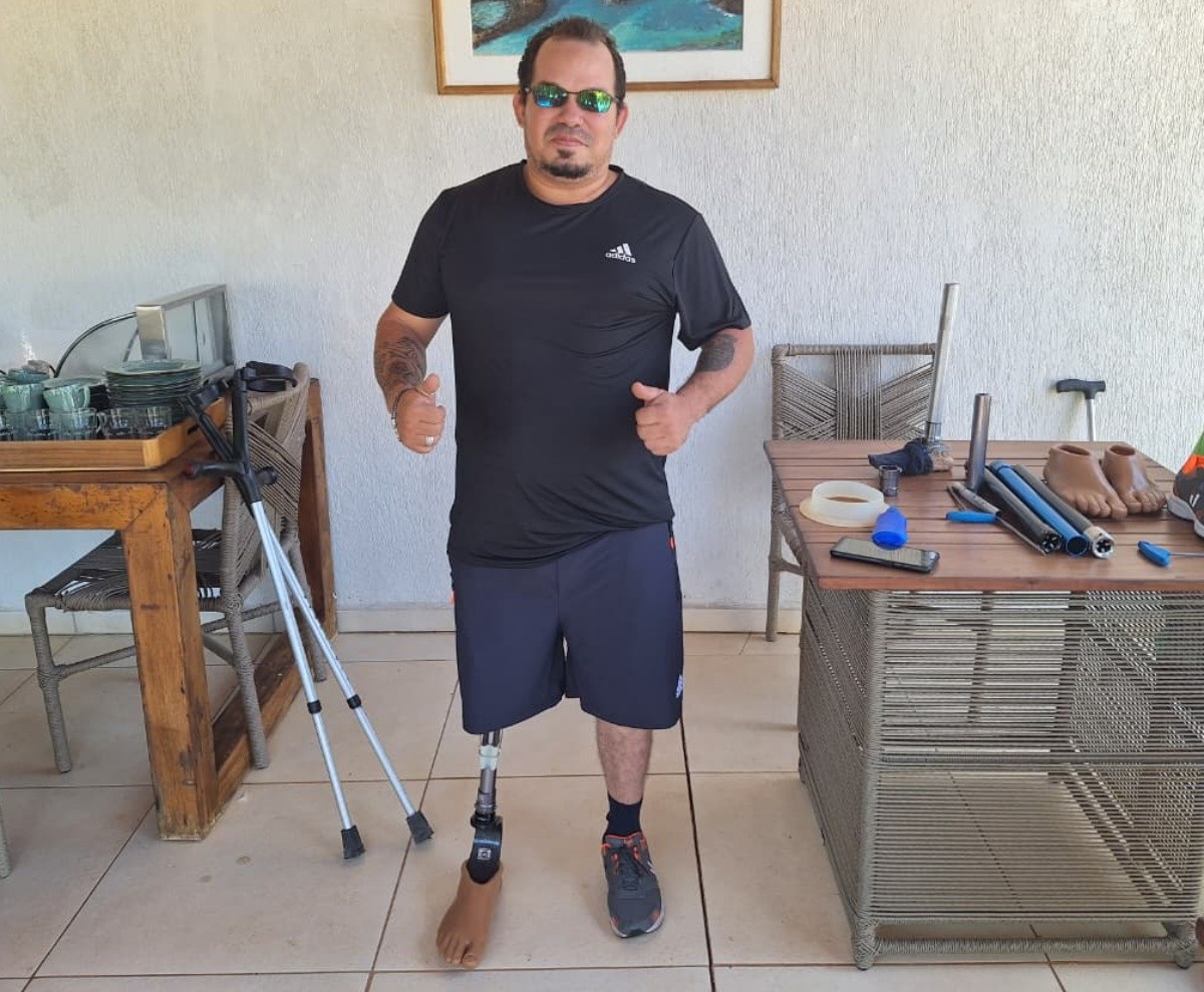Morador de Fernando de Noronha que perdeu a perna inicia treinamento para retomar prática de esportes: ‘Quero voltar a surfar’