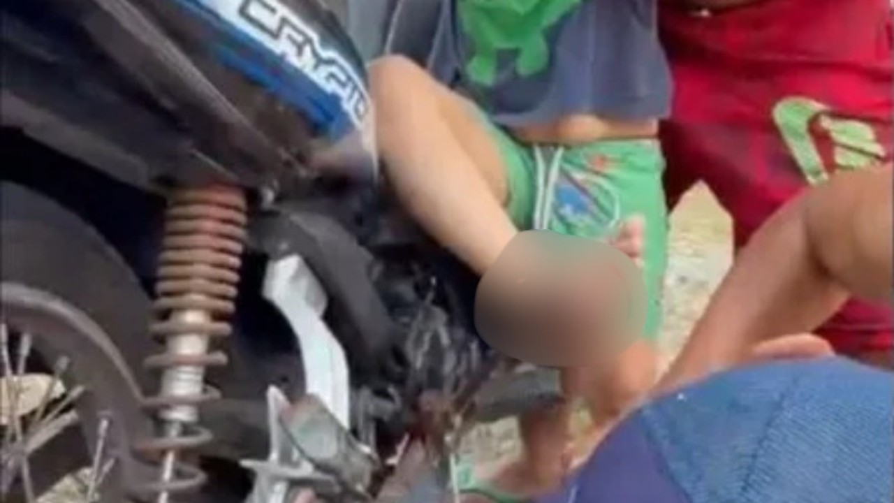 Menino de 4 anos tem pé perfurado e preso em pedal de motocicleta após veículo tombar no AM