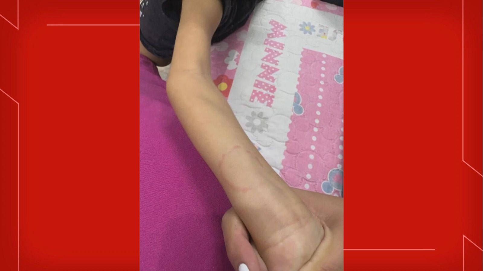 Mãe denuncia suspeita de maus-tratos à filha em creche particular do DF