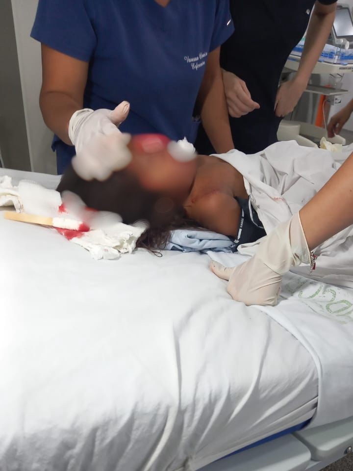 Criança de três anos é baleada no rosto durante troca de tiros em RO