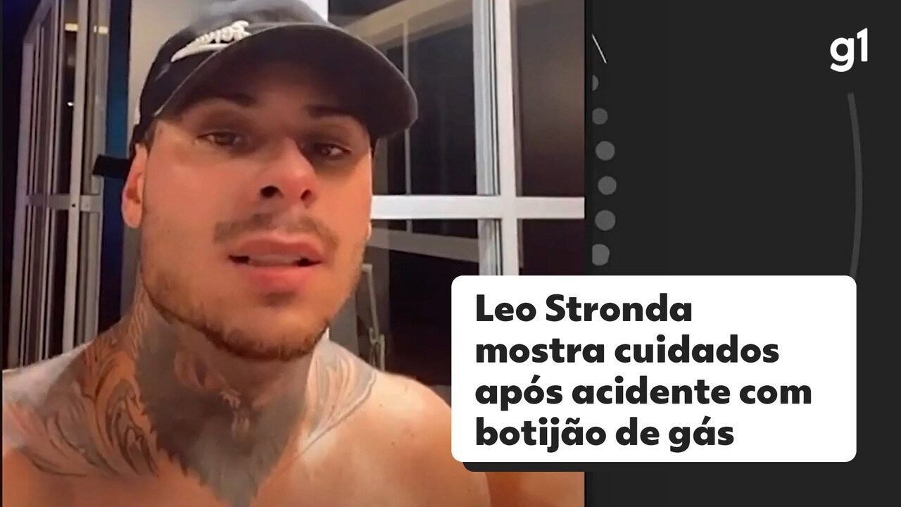 Após alta, Leo Stronda mostra cuidados com queimaduras provocadas por ...