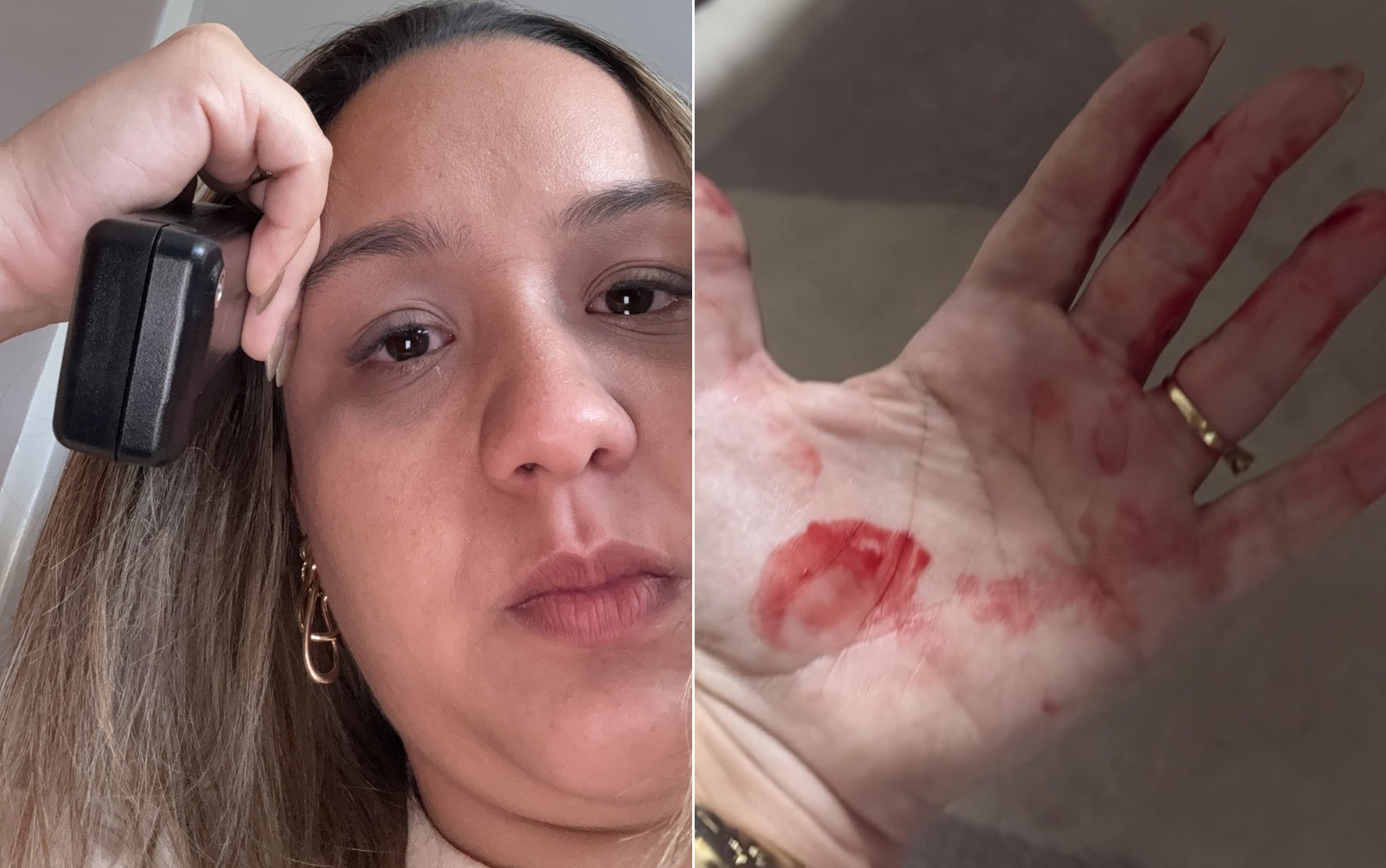 Advogada que denuncia agressão do ex-companheiro desabafa sobre medo seis meses após violência e cobra punição: ‘Continuo com medo’