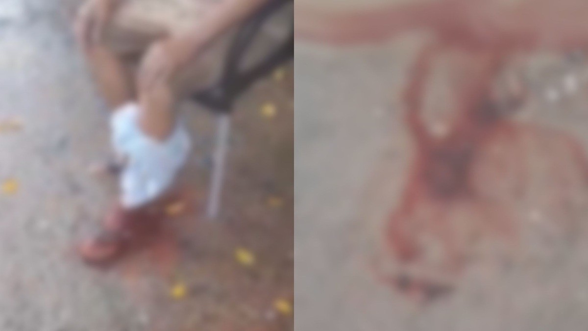 Idoso em situação de rua é atacado por pitbull na Zona Oeste do Recife