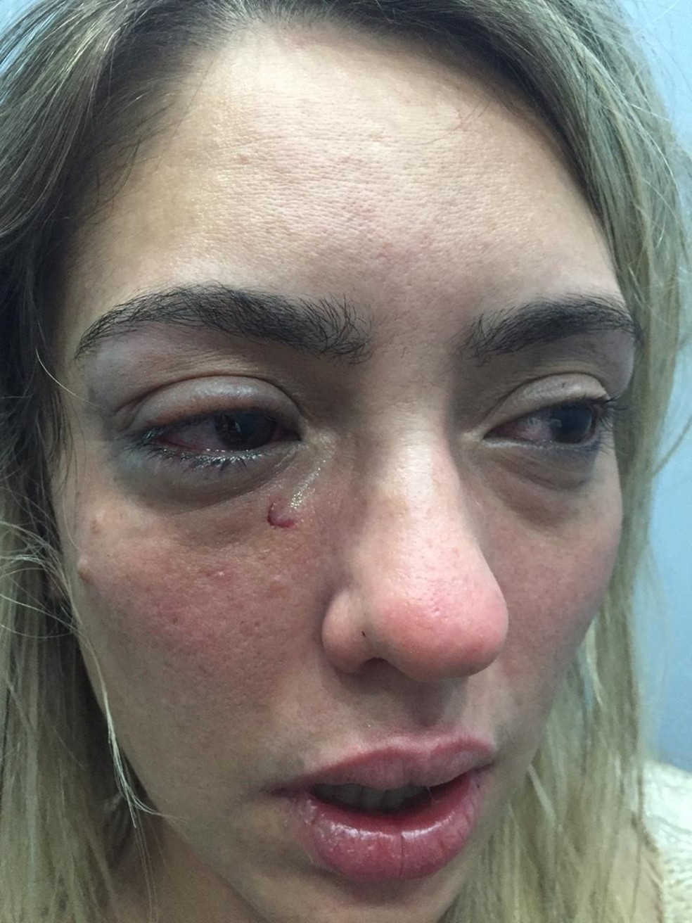 Myriam Gadelha denunciou prefeito de Sousa após ser agredida na Paraíba — Foto: Arquivo Pessoal