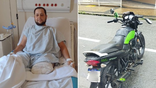 Cachorro morre e motoboy perde a perna em acidente de trânsito no litoral de SP: 'eu quero andar'