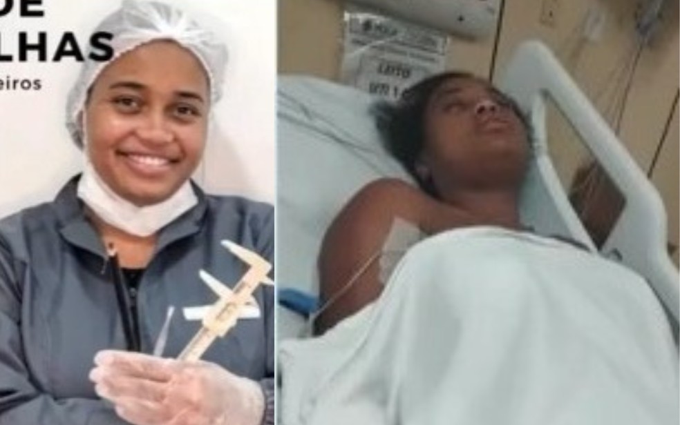 Mylenna, antes e depois de sofrer com os sintomas da porfiria aguda em Feira de Santana — Foto: Reprodução/TV Subaé