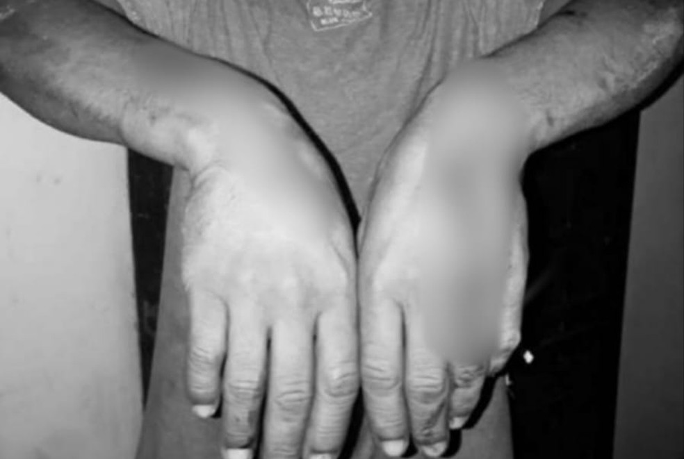 Marcelo foi torturado por policiais militares em 2018 e agora pede indenização do Estado — Foto: Arquivo pessoal