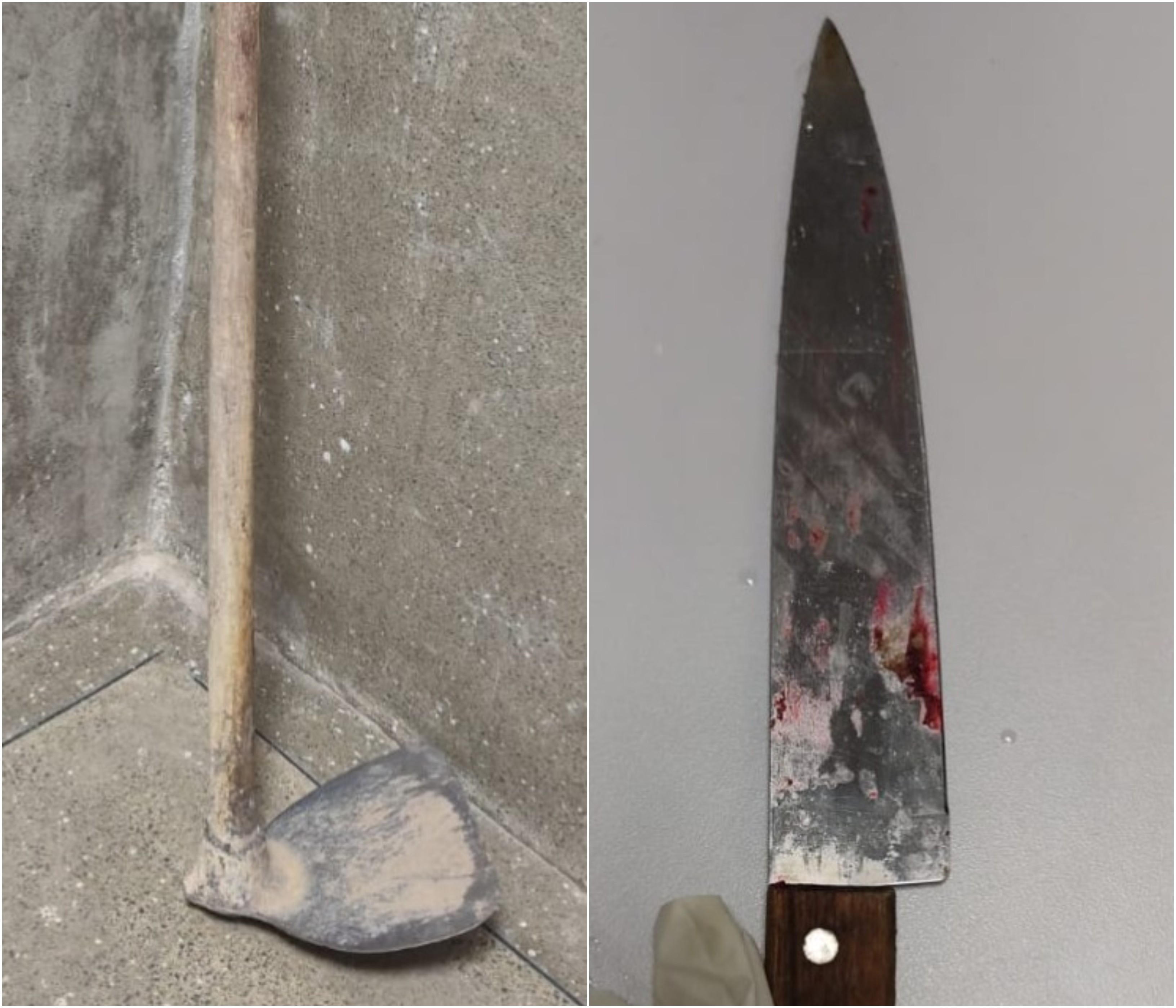 Mulher esfaqueia irmão ao tentar se defender de ataque com enxada em Boa Vista