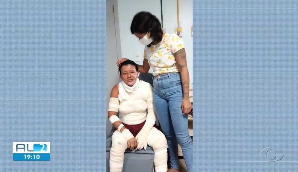 Claudiane Maria Joventino, que teve o corpo queimado pelo marido, ao lado da filha durante o tratamento no hospital em Maceió — Foto: Reprodução/TV Gazeta