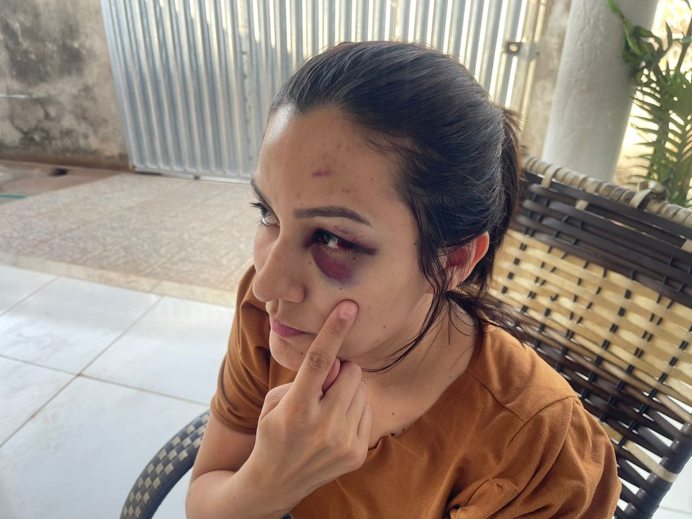 Enfermeira Carlene Nobre denuncia servidor do TJPI por violência doméstica — Foto: Christian Sousa /TV Clube