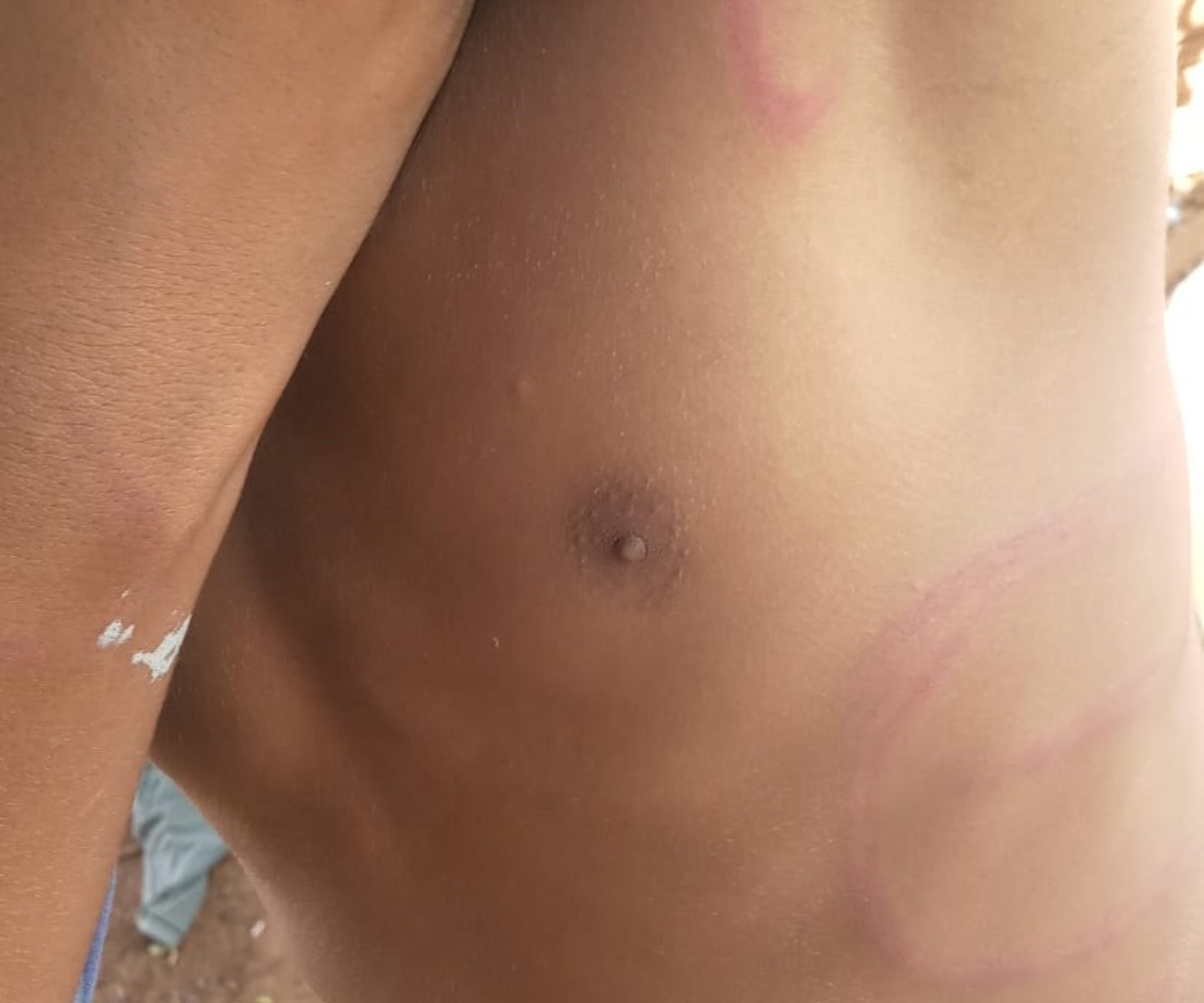 Homem é preso após agredir enteado com fio de telefone em Piracicaba