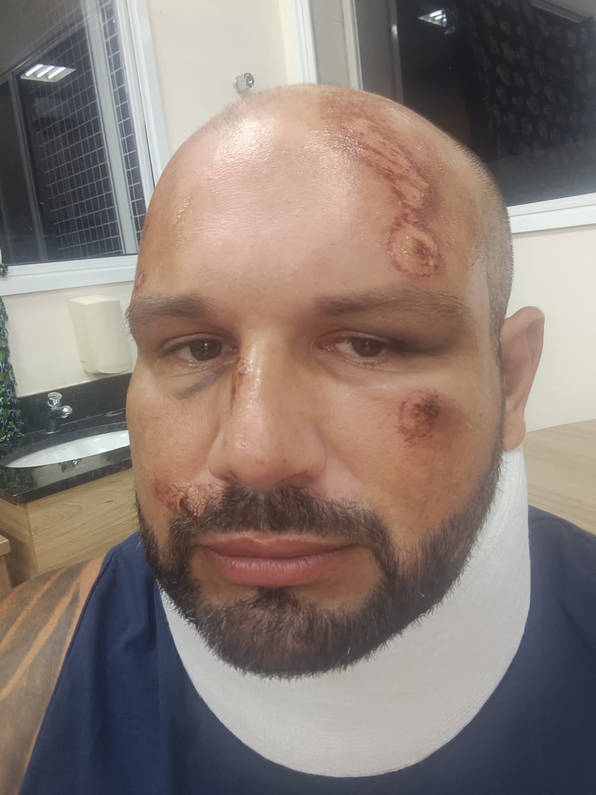 Empresa afirma que passageira acessou 'área proibida' antes de cair de ônibus em movimento no Litoral Norte de SP