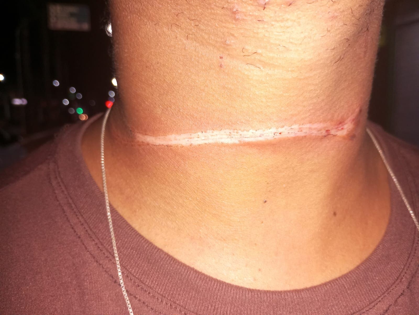 Motociclista tem pescoço atingido por fio quando seguia por avenida de Unaí