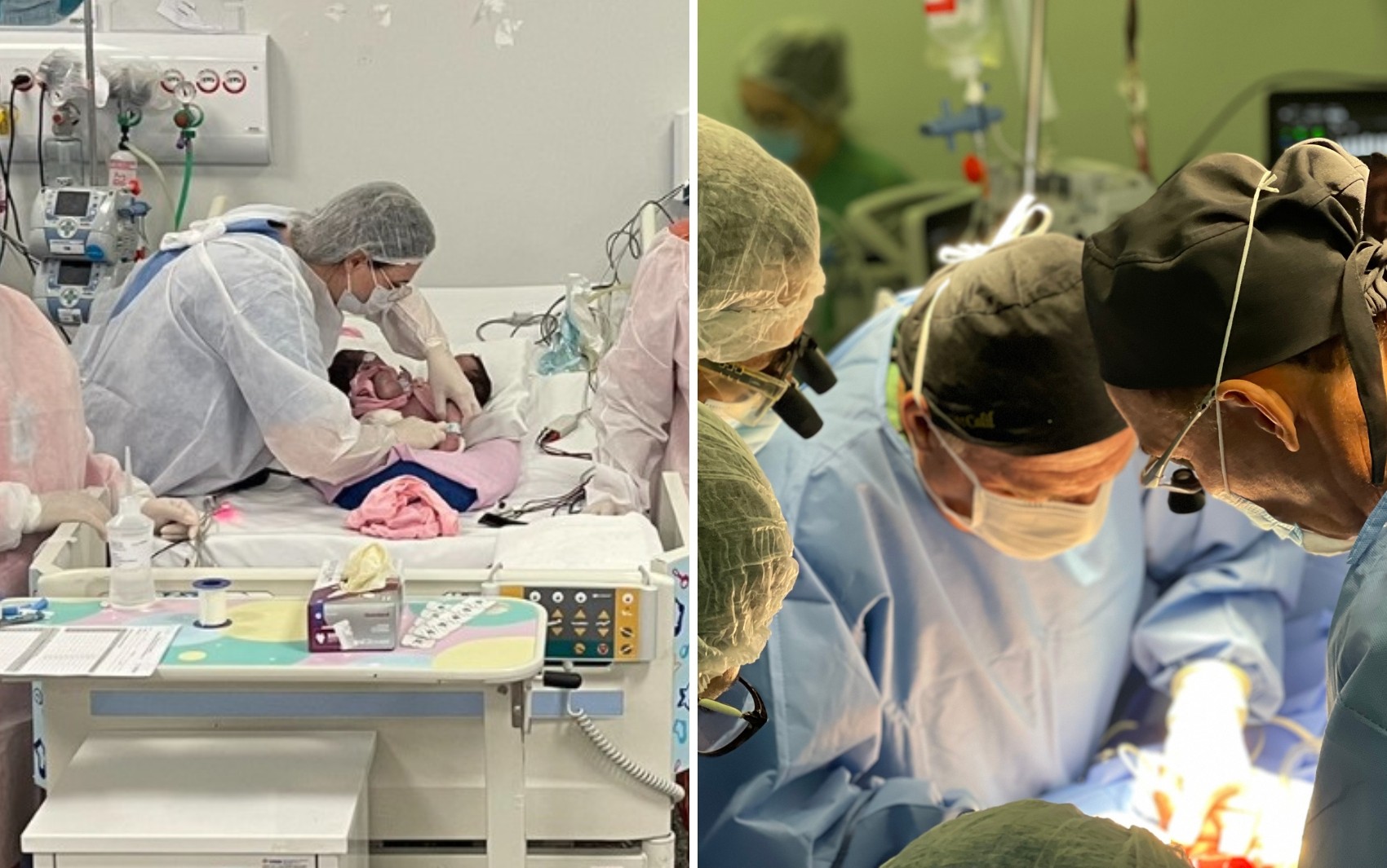 Siamesas de Manaus estão com quadro de saúde grave e respiram com ajuda de aparelhos após cirurgia de emergência em Goiânia