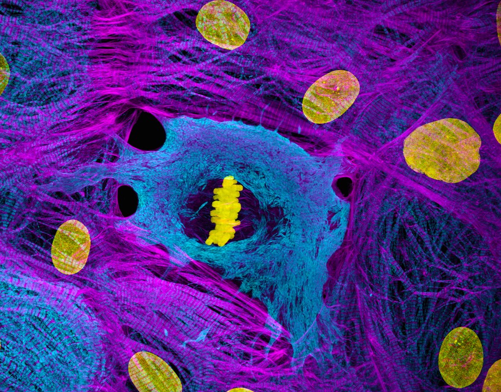 Células do músculo cardíaco derivadas de células-tronco com cromossomos condensados na metáfase. A imagem dos americanos Dylan Burnette e James Hayes ficou em 10 lugar no Nikon Small World 2025. — Foto: Dylan Burnette e James Hayes / Nikon Small World 2025