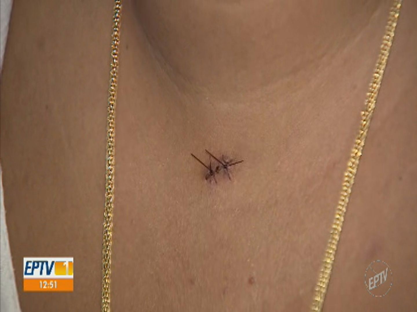 Carta com sangue, ameaças e facadas: sobrevivente após ataque de casal fala sobre intolerância religiosa