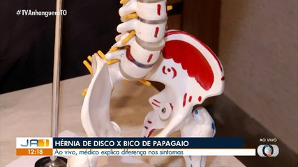 Médico explica diferença entre hérnia de disco e bico de papagaio