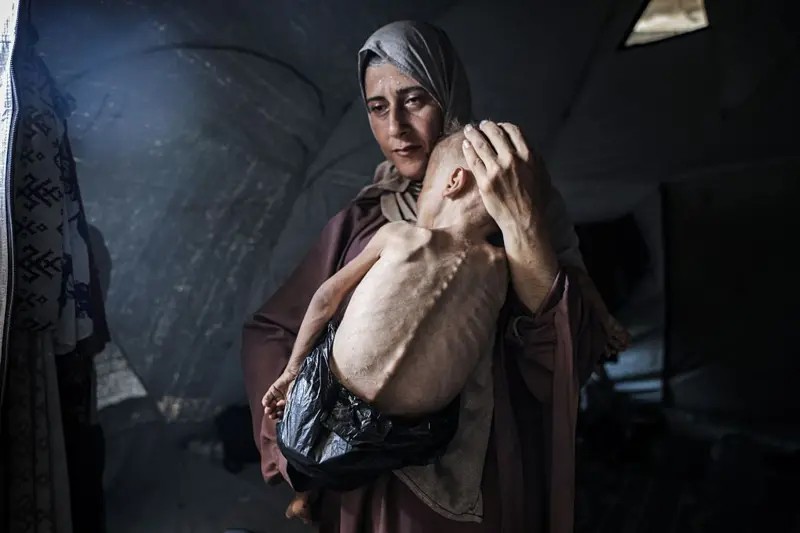 A história por trás da chocante foto do bebê faminto de Gaza