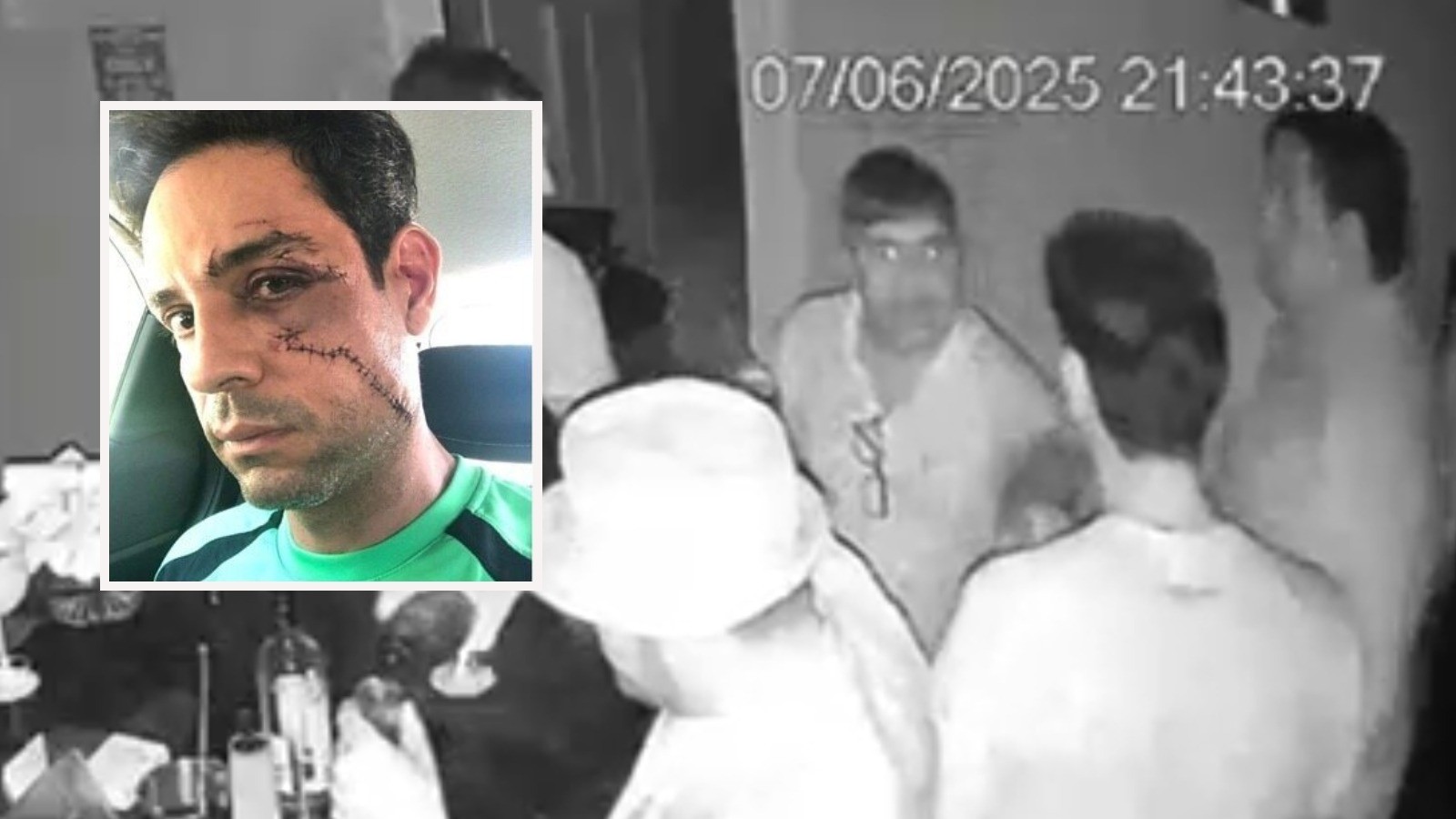 Vídeo: empresário é agredido com copo de vidro no rosto e sofre corte de 62 pontos em Fortaleza