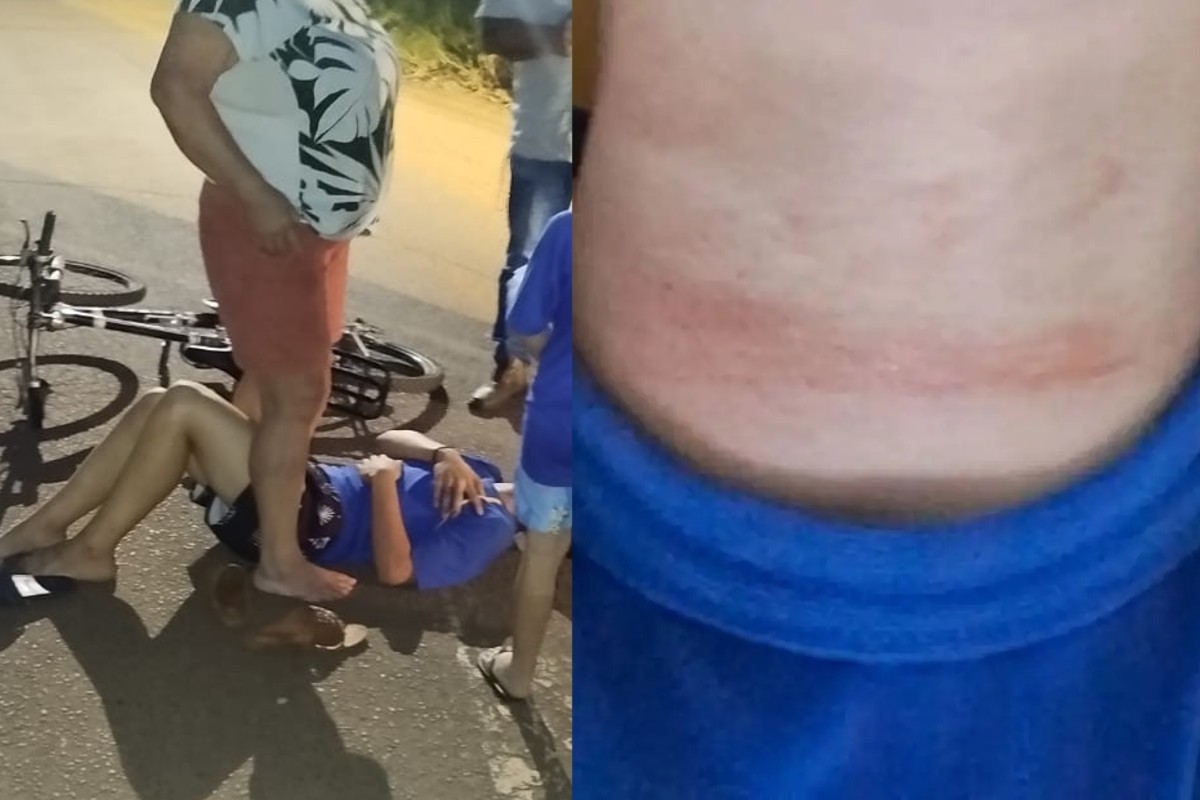 Menino de 13 anos trinca vértebra após enroscar pescoço em fio solto enquanto voltava da escola de bicicleta