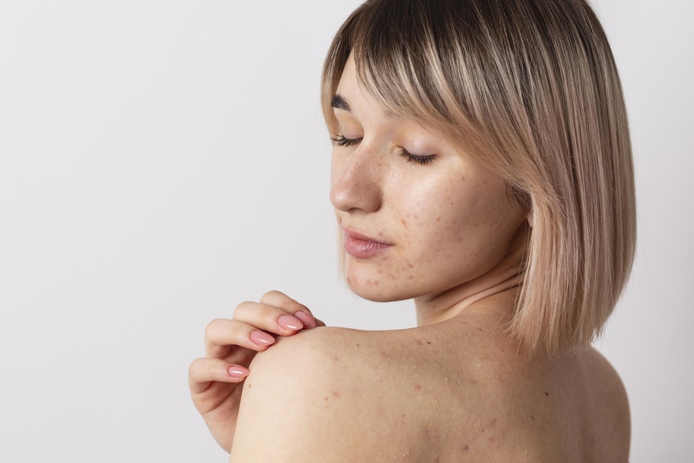 G1 > Ciência e Saúde - NOTÍCIAS - Inverno intensifica doenças de pele