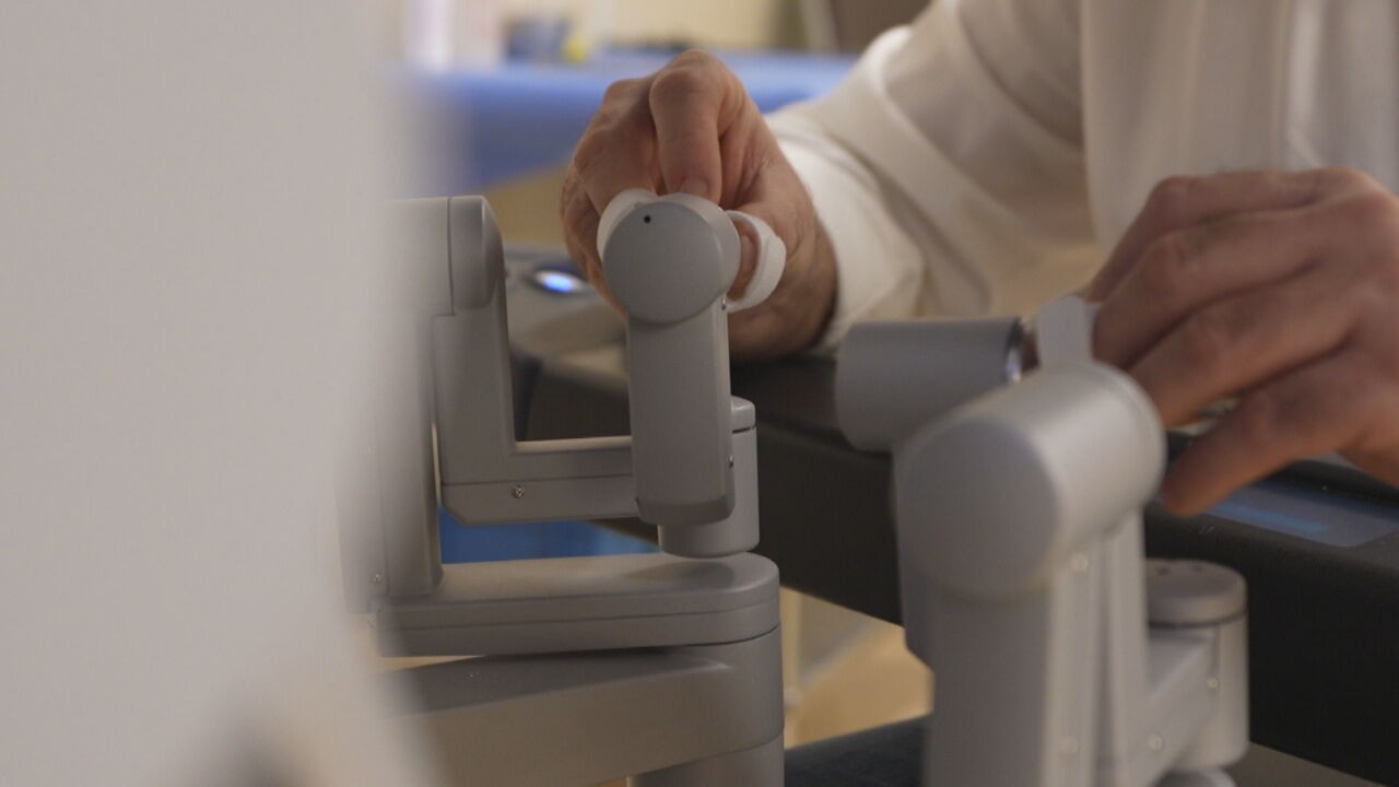 Transplante inédito de rim entre vivos feito por robôs dá no