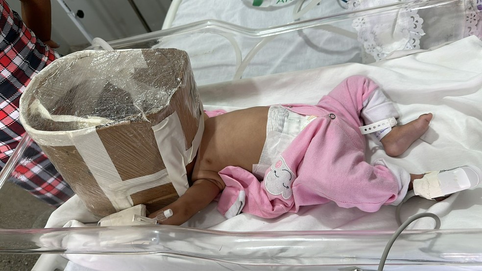 Respirador improvisado com papelão e plástico para bebê que precisava de transferência para Natal — Foto: Cedida
