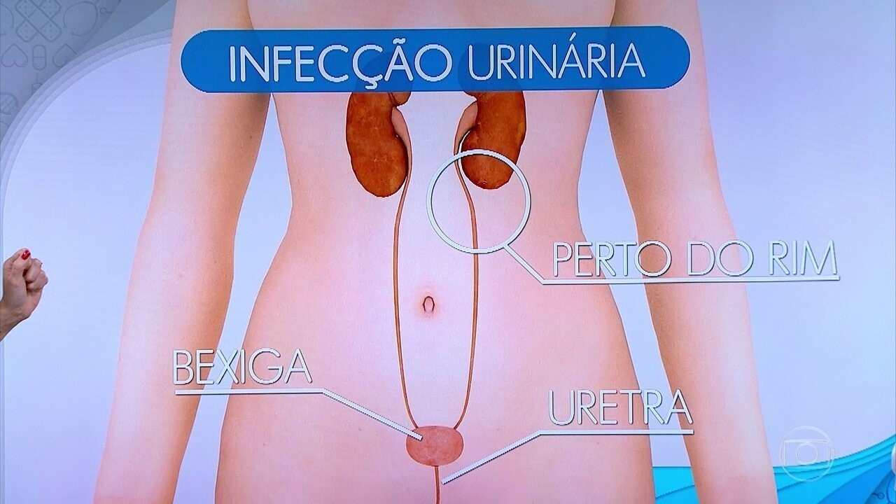 As causas da infecção urinária, como prevenir e tratar | G1