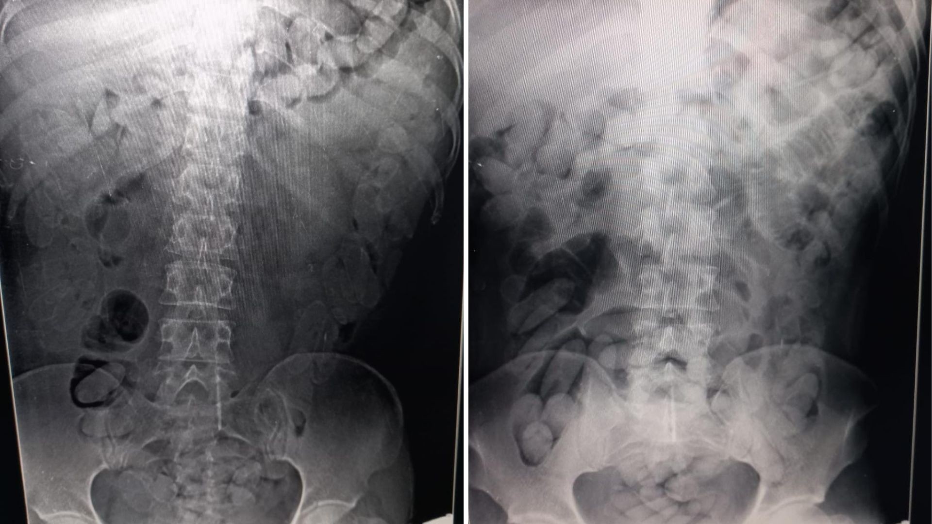 Você Não Tá Convidada pro Meu Bat Mitzvá!