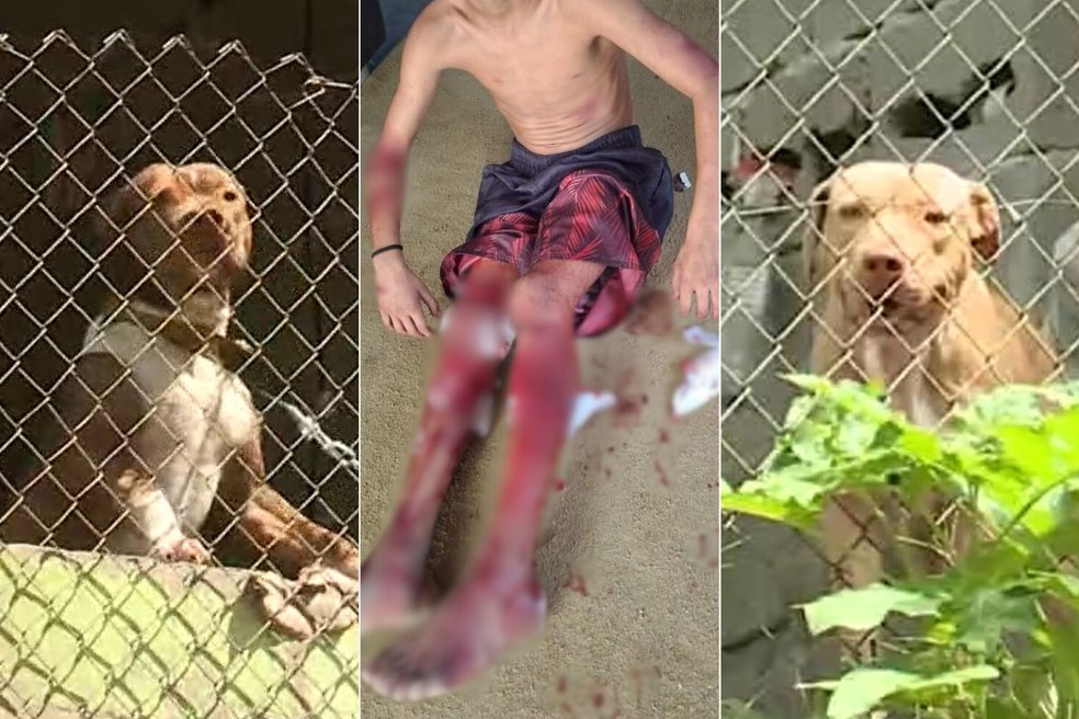 Menino de 12 anos foi hospitalizado após ser atacado por dois cães da raça pit bull em Registro (SP) — Foto: Rinaldo Rori/TV Tribuna e Arquivo Pessoal