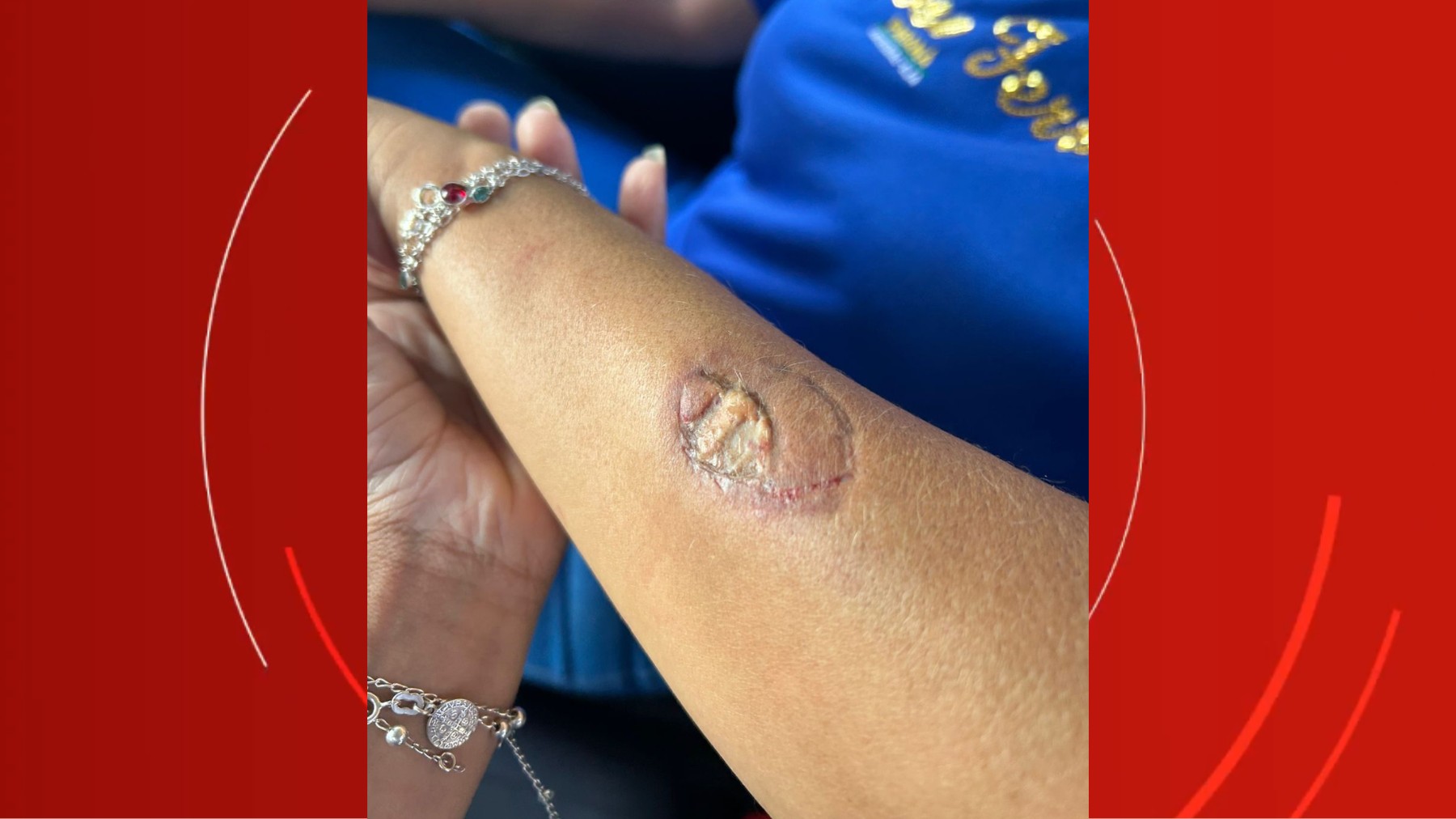 Mãe de aluno agride funcionárias e morde diretora dentro de escola no Paraná