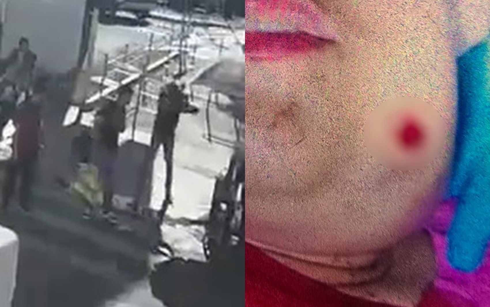 Jovem autista é baleada no rosto após sorrir para homem enquanto trabalhava na barraca da família em Goiânia; vídeo