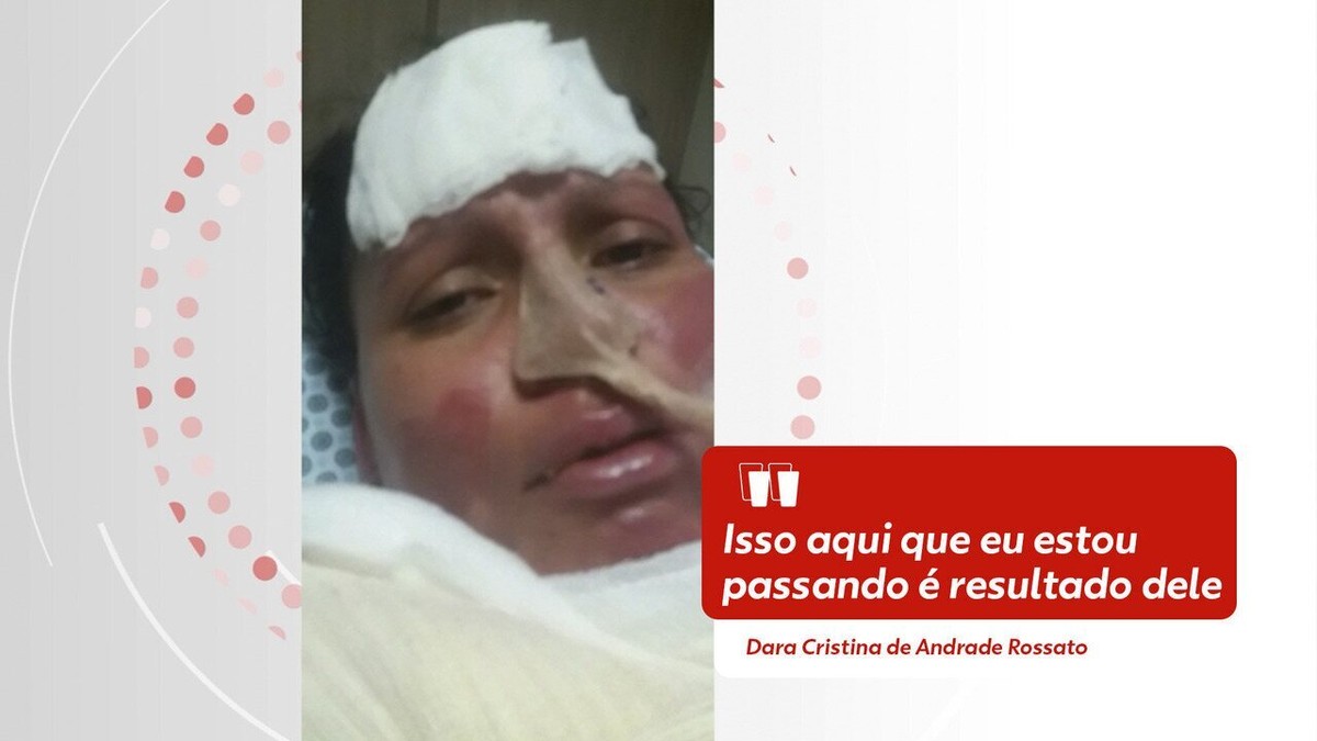 V Deo Mulher Volta Do Coma E Denuncia Que Marido A Incendiou