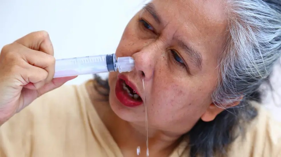 Os sistemas de irrigação nasal podem ser um caminho fácil para que a Naegleria fowleri chegue ao cérebro — Foto: Getty Images via BBC