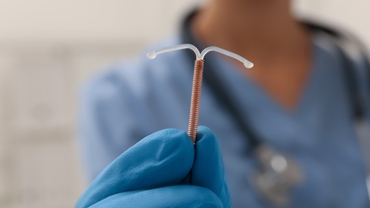 DIU hormonal Mirena tem prazo estendido de 5 para 8 anos para contracepção - FDA dos EUA já havia autorizado uso prolongado; especialistas dizem que mudança reduz trocas e mantém eficácia.