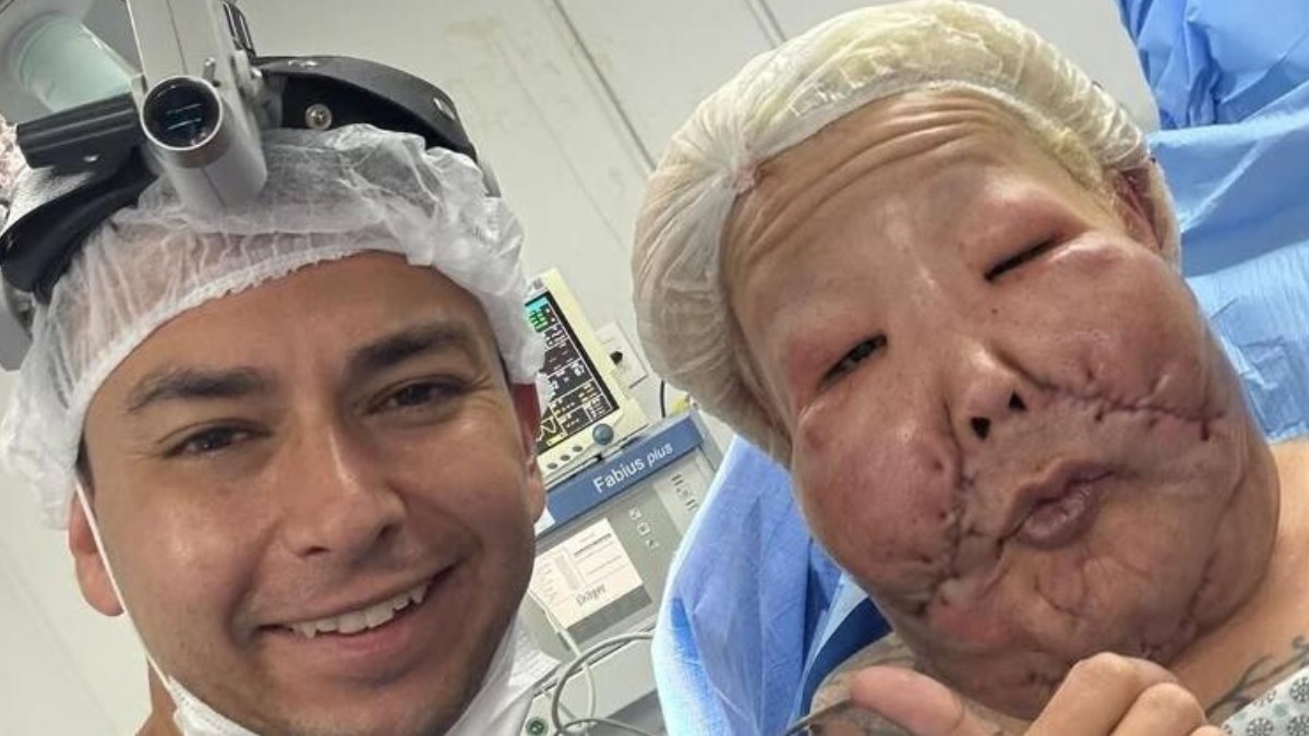 Juju do Pix deve passar por novo procedimento em até 6 meses; veja antes e depois da influenciadora