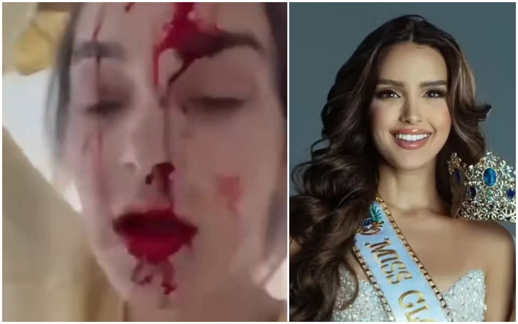 Miss Venezuela acusa o próprio estilista de agredi-la dentro de quarto de hotel em Cannes; VÍDEO